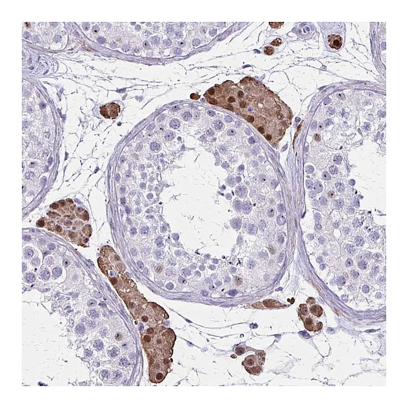 Atlas Antibodies Anti-OR51B5 Antibody