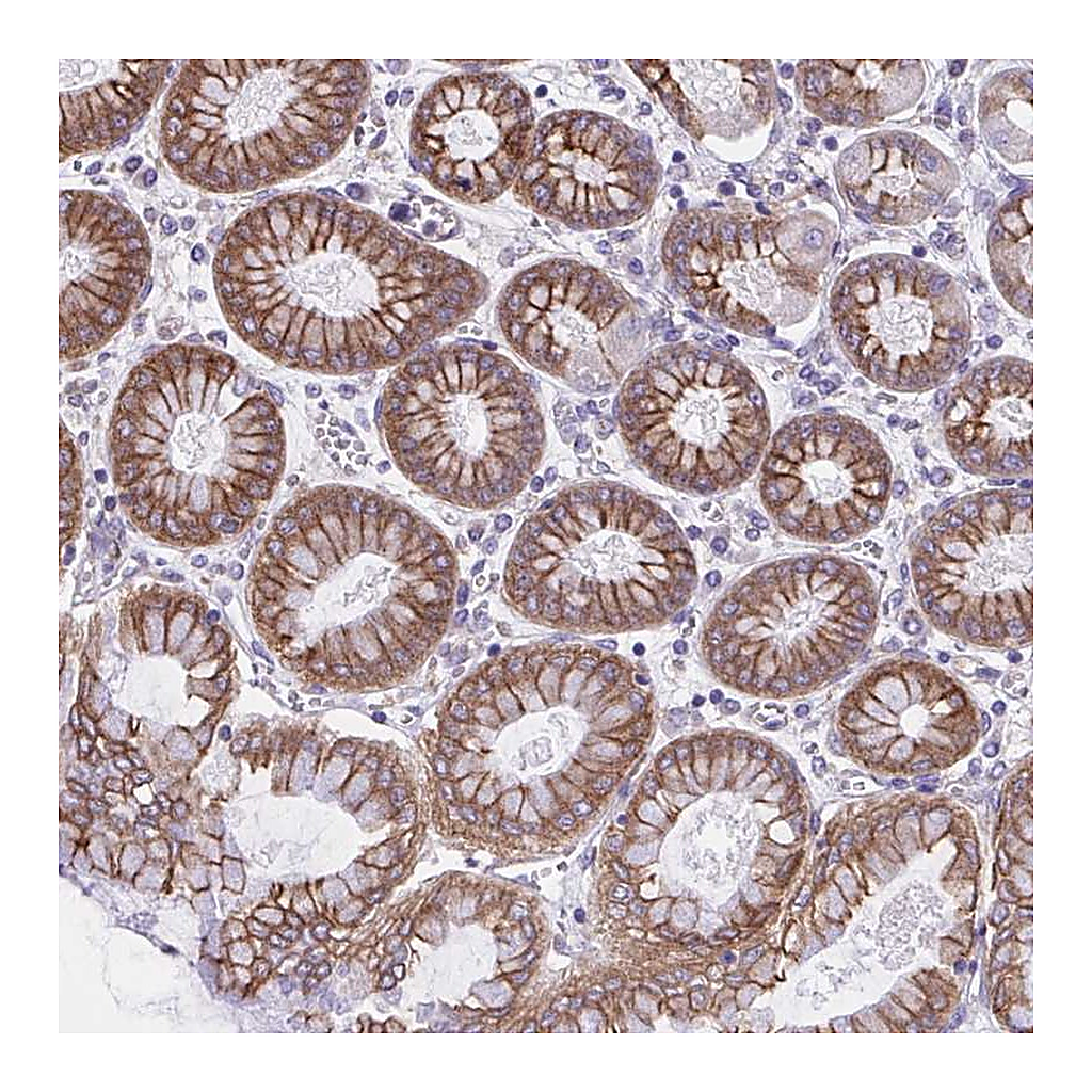 Atlas Antibodies Anti-OR51M1 Antibody