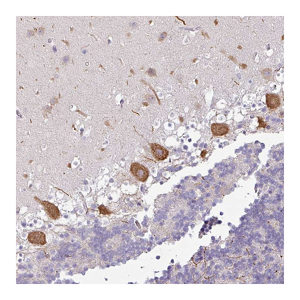 Atlas Antibodies Anti-OR52D1 Antibody