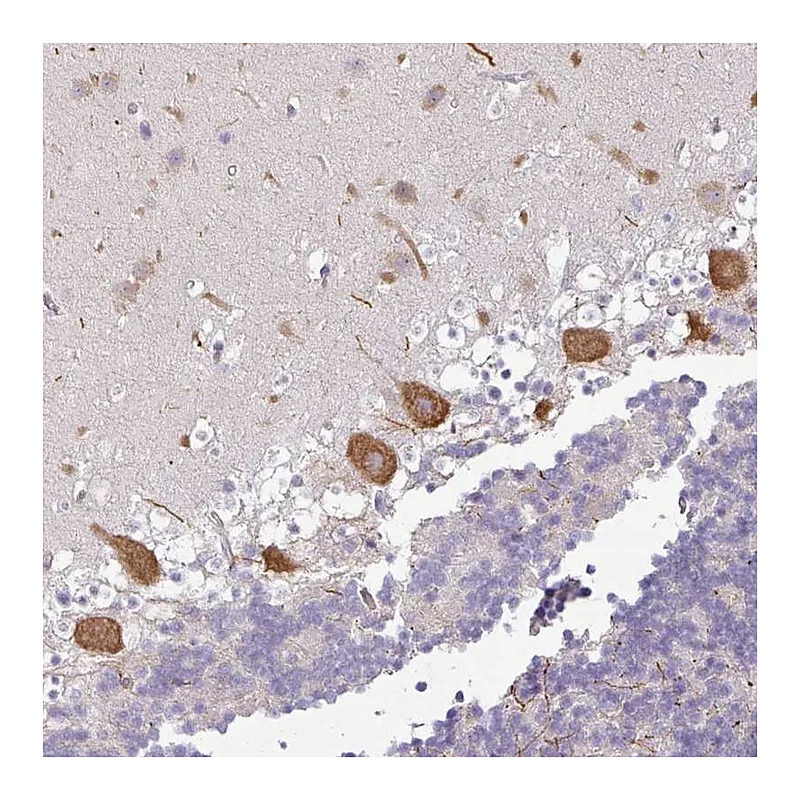 Atlas Antibodies Anti-OR52D1 Antibody