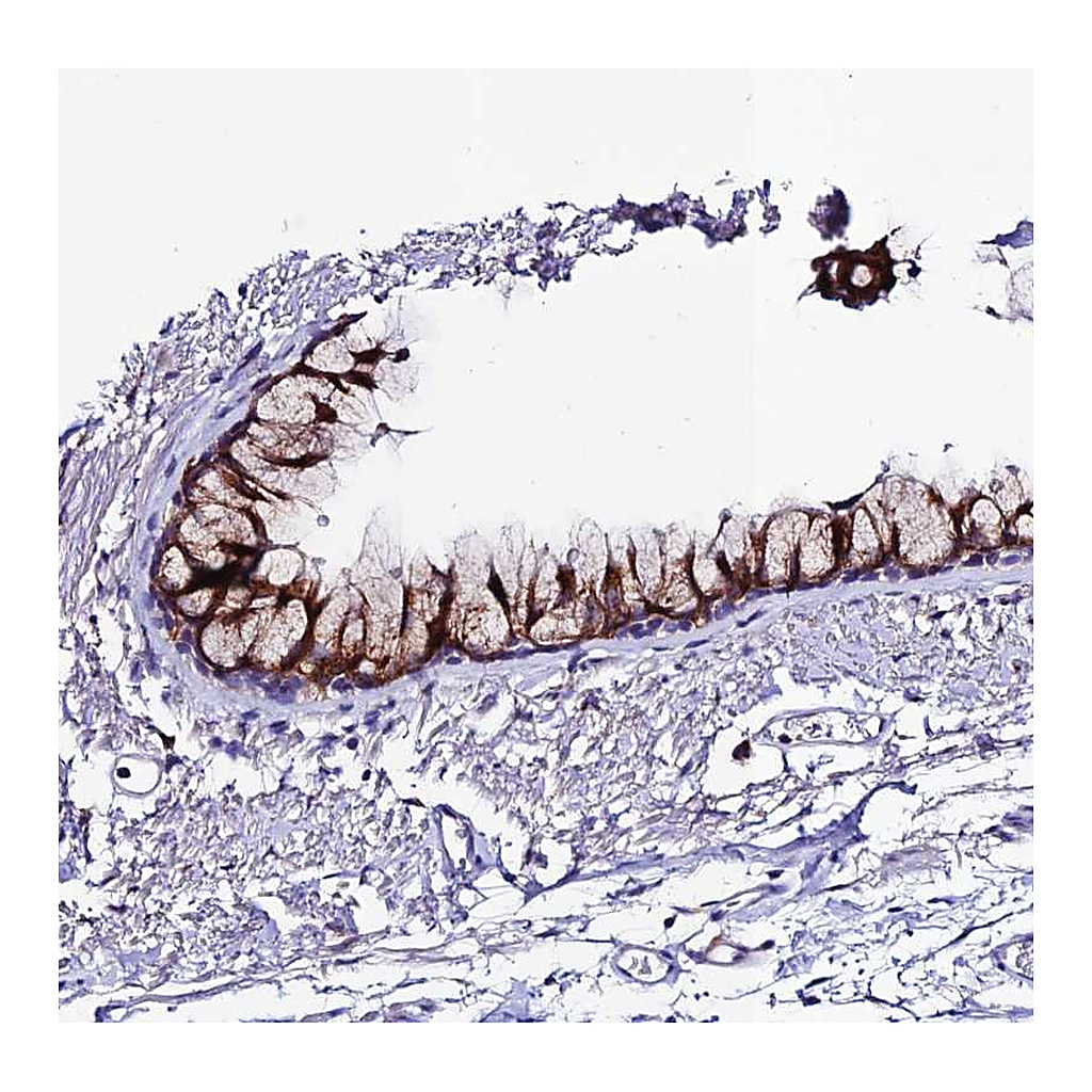 Atlas Antibodies Anti-OR51Q1 Antibody