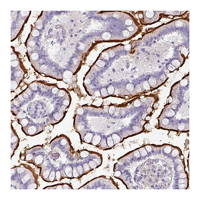 Atlas Antibodies Anti-OR52N1 Antibody