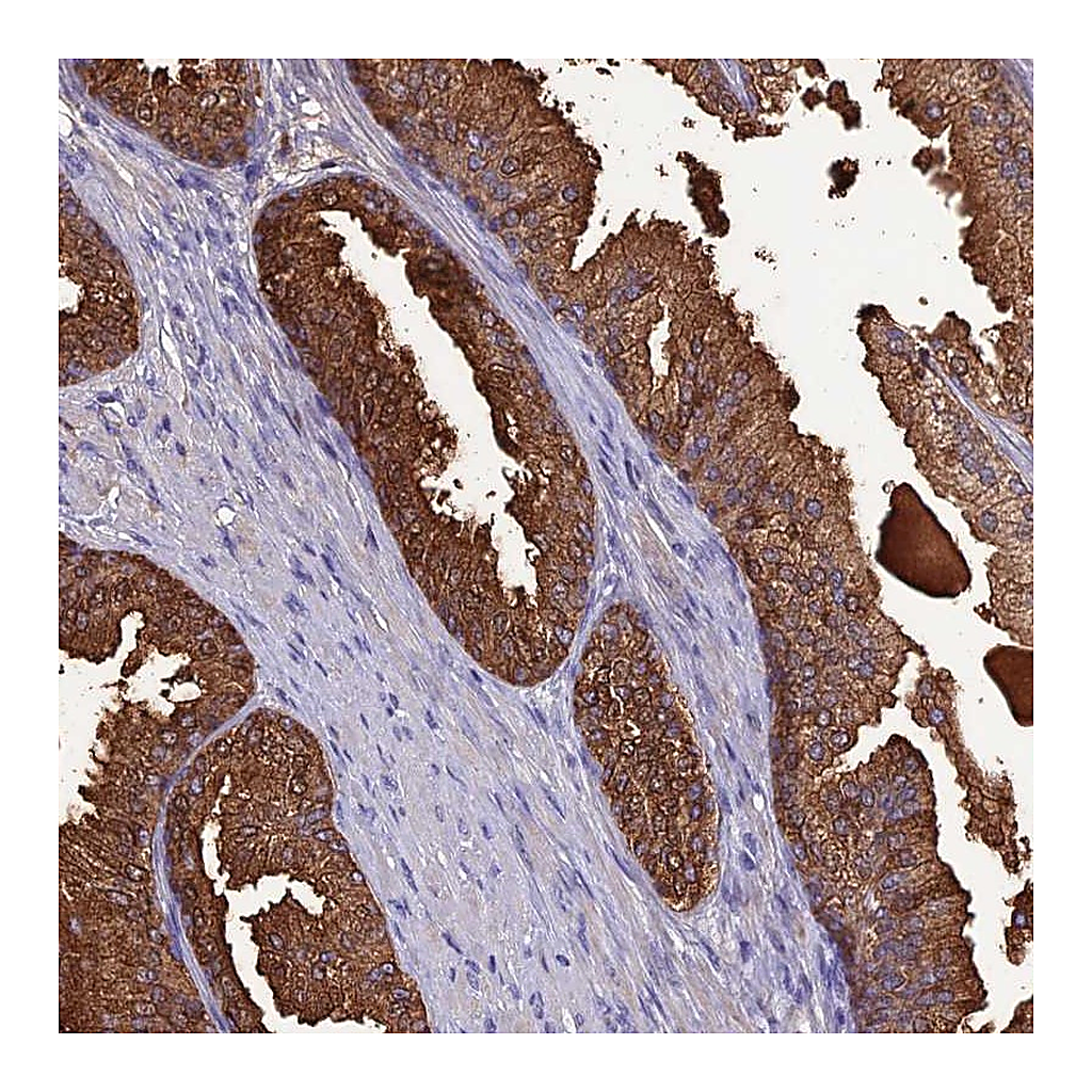 Atlas Antibodies Anti-OR56B1 Antibody