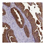 Atlas Antibodies Anti-OR56B1 Antibody
