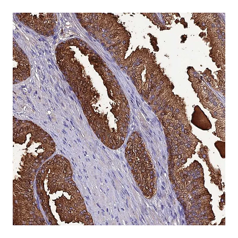 Atlas Antibodies Anti-OR56B1 Antibody