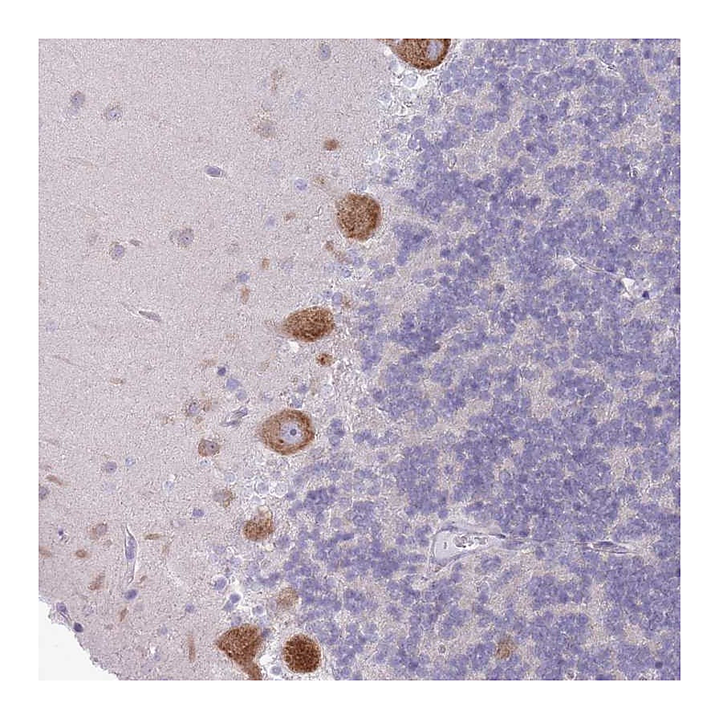 Atlas Antibodies Anti-OR5L2 Antibody