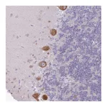 Atlas Antibodies Anti-OR5L2 Antibody