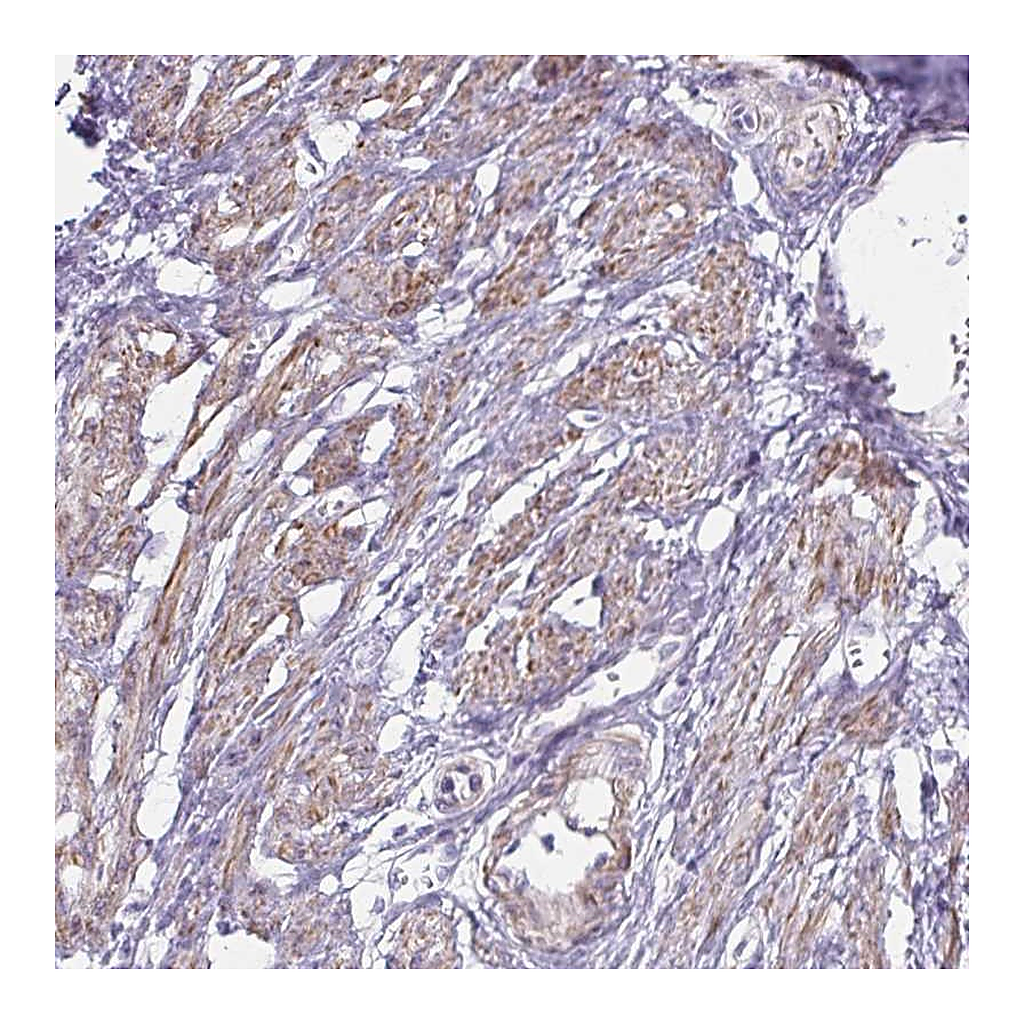 Atlas Antibodies Anti-OR5P3 Antibody