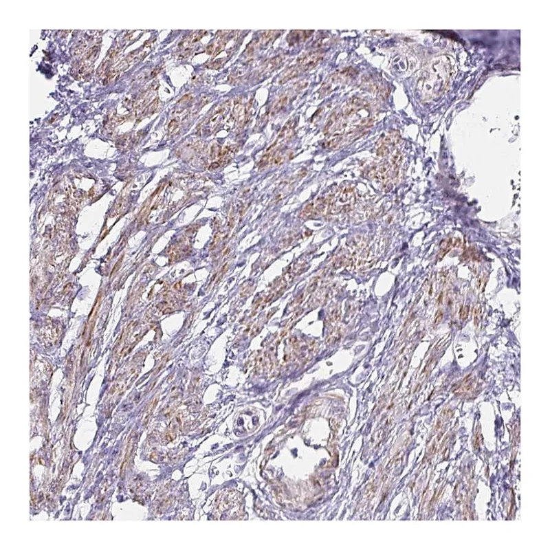 Atlas Antibodies Anti-OR5P3 Antibody