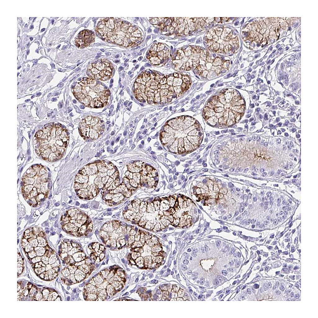 Atlas Antibodies Anti-OR5F1 Antibody