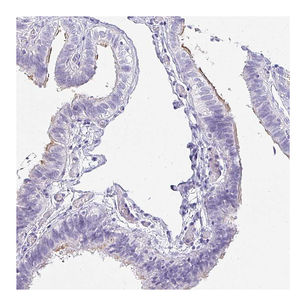 Atlas Antibodies Anti-OR5J2 Antibody