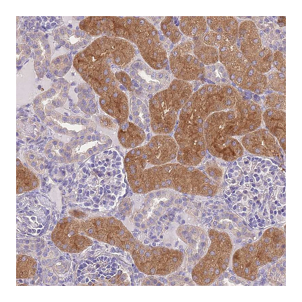 Atlas Antibodies Anti-OR5T1 Antibody
