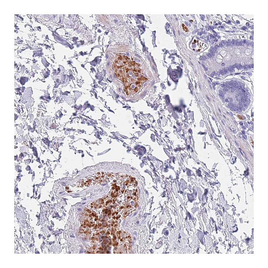 Atlas Antibodies Anti-OR5D16 Antibody