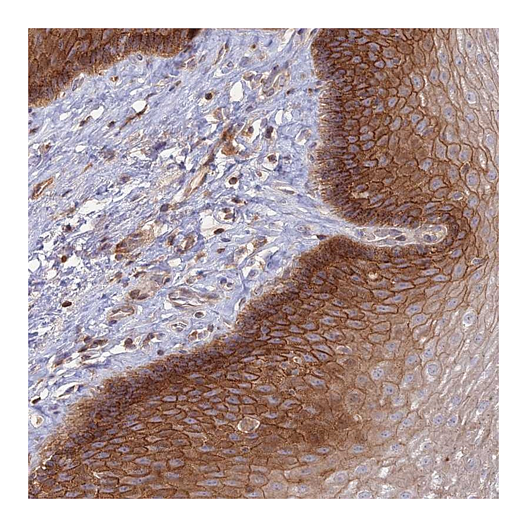 Atlas Antibodies Anti-OR5T3 Antibody