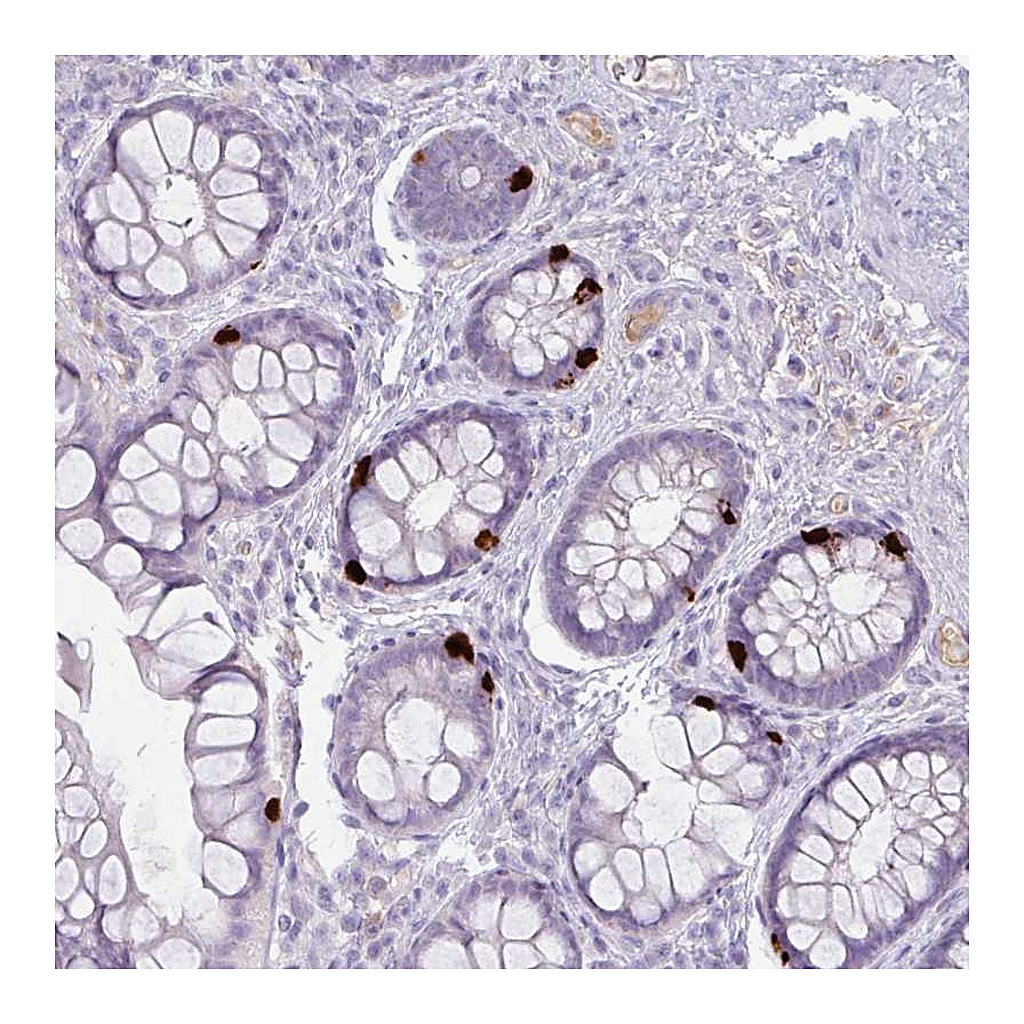 Atlas Antibodies Anti-OR6C6 Antibody
