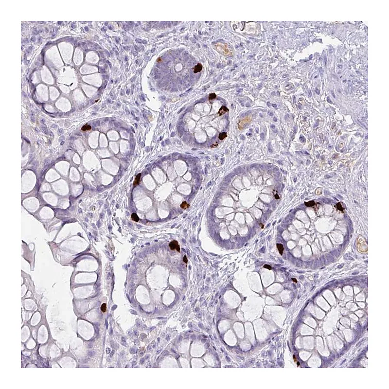 Atlas Antibodies Anti-OR6C6 Antibody
