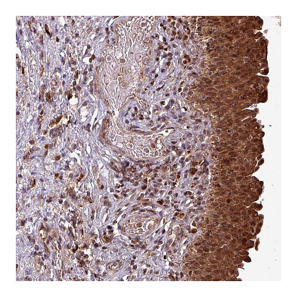 Atlas Antibodies Anti-OR6B1 Antibody