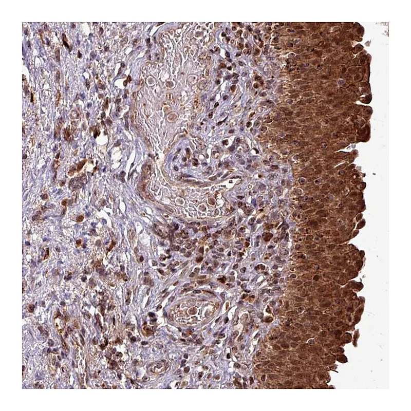 Atlas Antibodies Anti-OR6B1 Antibody