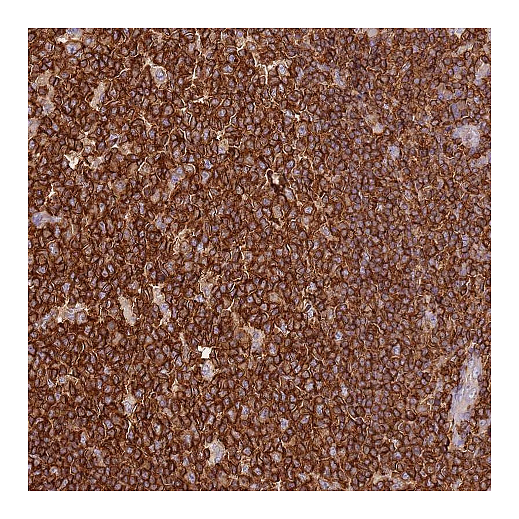Atlas Antibodies Anti-OR6P1 Antibody