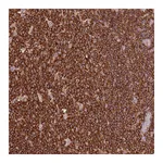 Atlas Antibodies Anti-OR6P1 Antibody