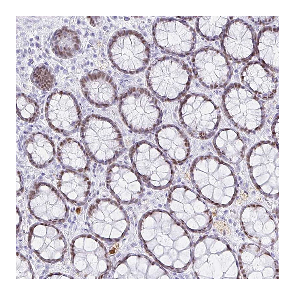 Atlas Antibodies Anti-OR6T1 Antibody