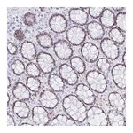 Atlas Antibodies Anti-OR6T1 Antibody