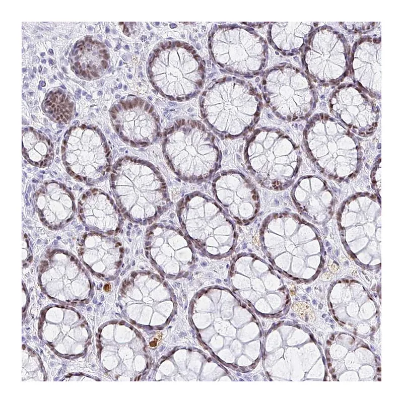 Atlas Antibodies Anti-OR6T1 Antibody