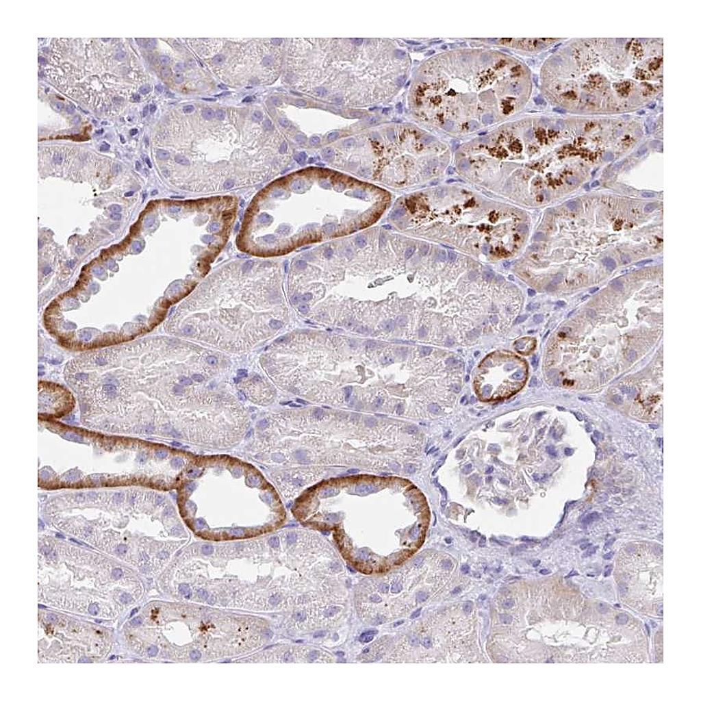 Atlas Antibodies Anti-OR6N2 Antibody
