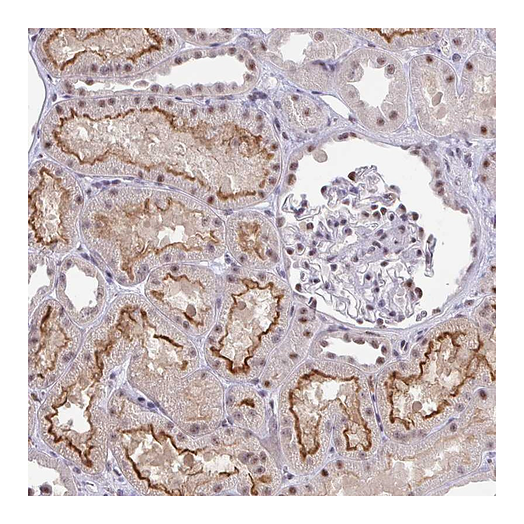 Atlas Antibodies Anti-OR6K3 Antibody