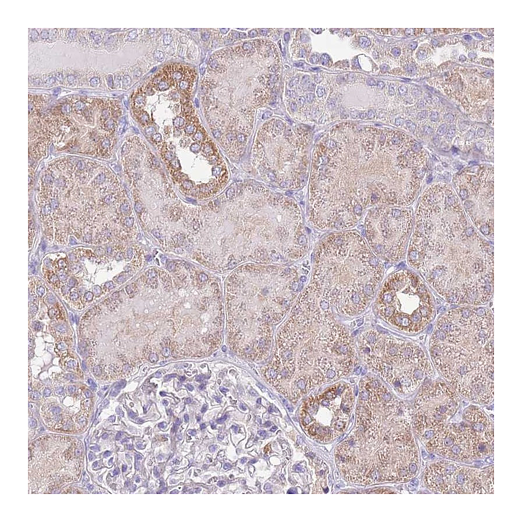 Atlas Antibodies Anti-OR6M1 Antibody