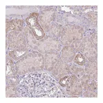Atlas Antibodies Anti-OR6M1 Antibody