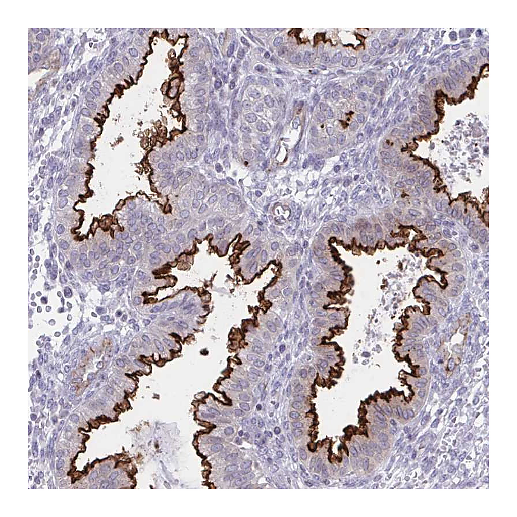 Atlas Antibodies Anti-OR7A5 Antibody