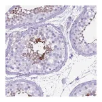 Atlas Antibodies Anti-OR7C1 Antibody