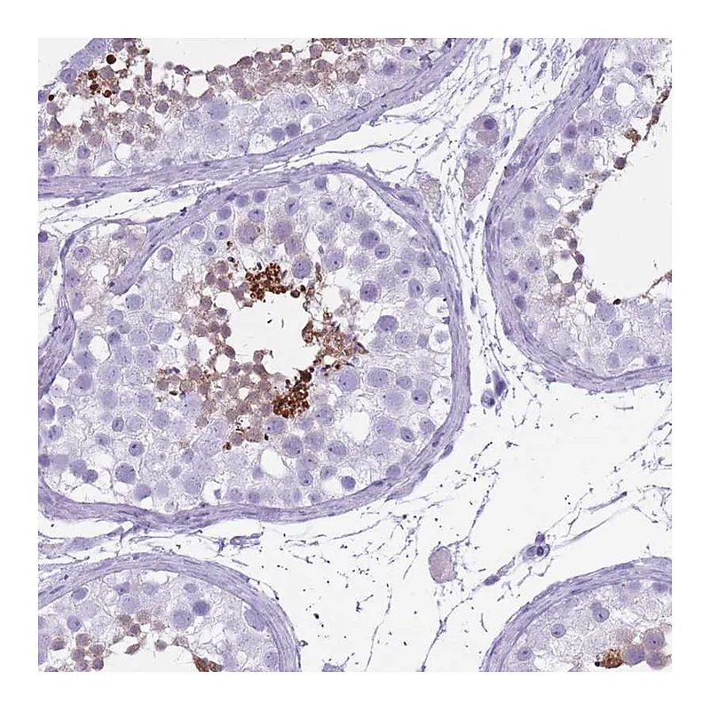 Atlas Antibodies Anti-OR7C1 Antibody