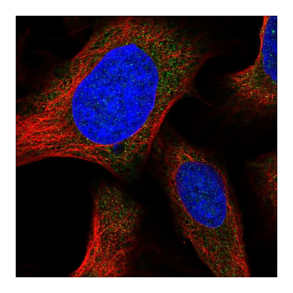 Atlas Antibodies Anti-ORAI1 Antibody