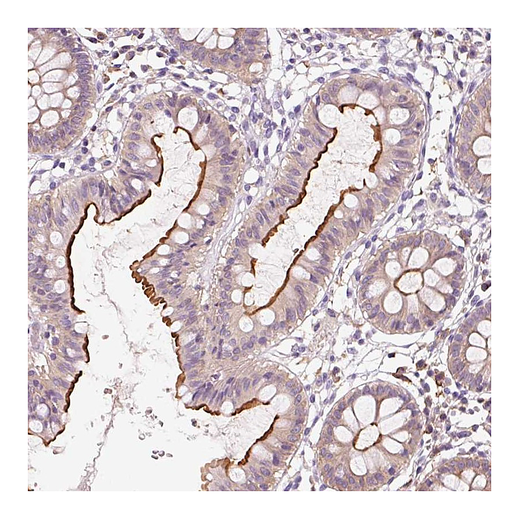 Atlas Antibodies Anti-OR8K1 Antibody
