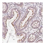 Atlas Antibodies Anti-OR8K1 Antibody