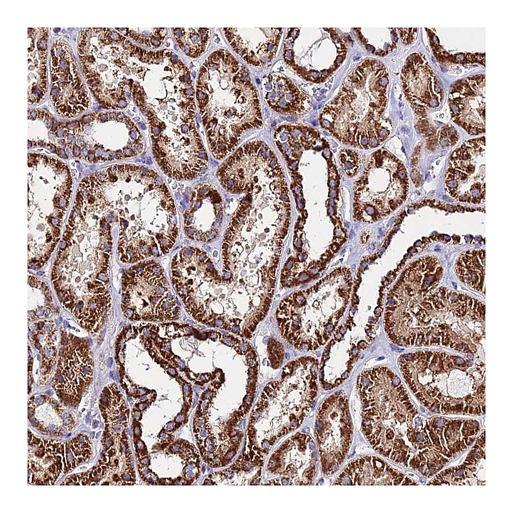 Atlas Antibodies Anti-OR8S1 Antibody