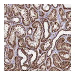 Atlas Antibodies Anti-OR8S1 Antibody