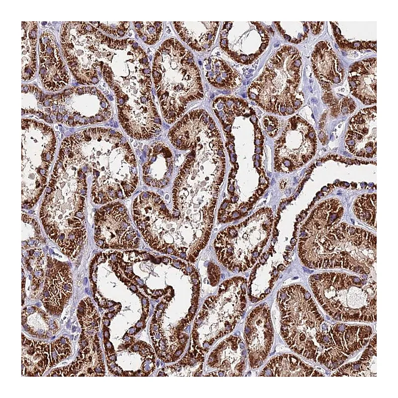 Atlas Antibodies Anti-OR8S1 Antibody