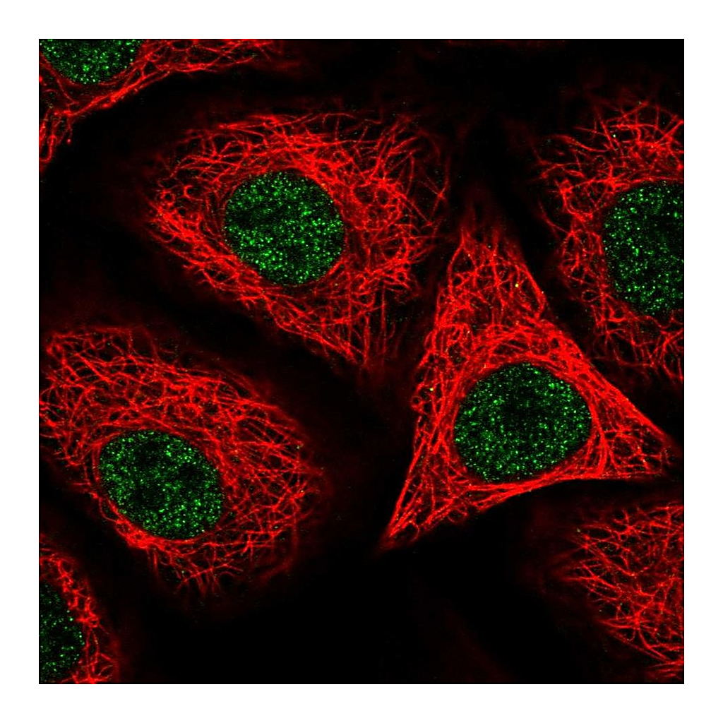 Atlas Antibodies Anti-ORAI2 Antibody