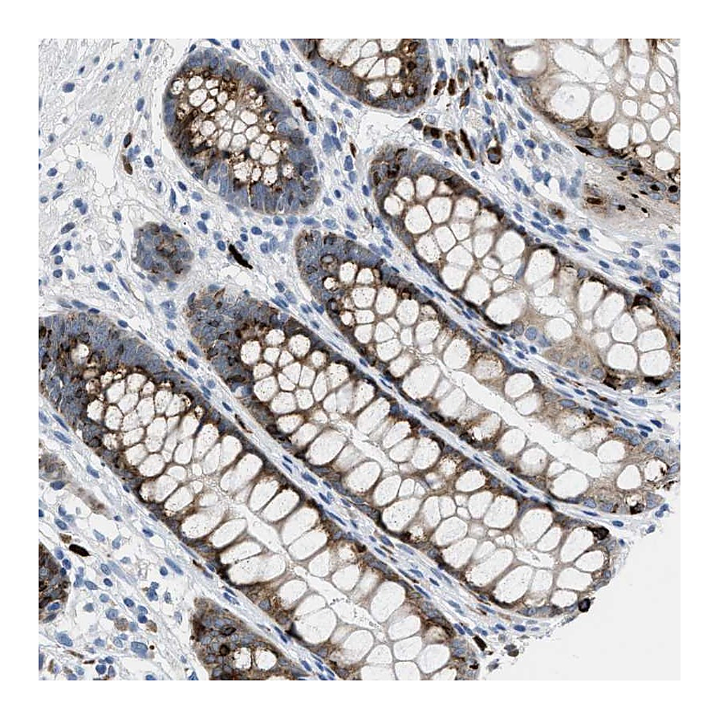 Atlas Antibodies Anti-OR9K2 Antibody