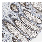 Atlas Antibodies Anti-OR9K2 Antibody