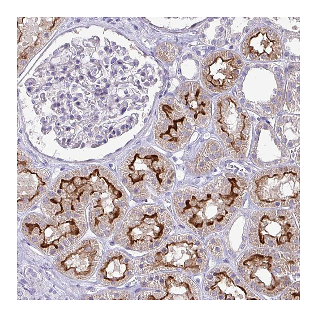 Atlas Antibodies Anti-OR8D1 Antibody