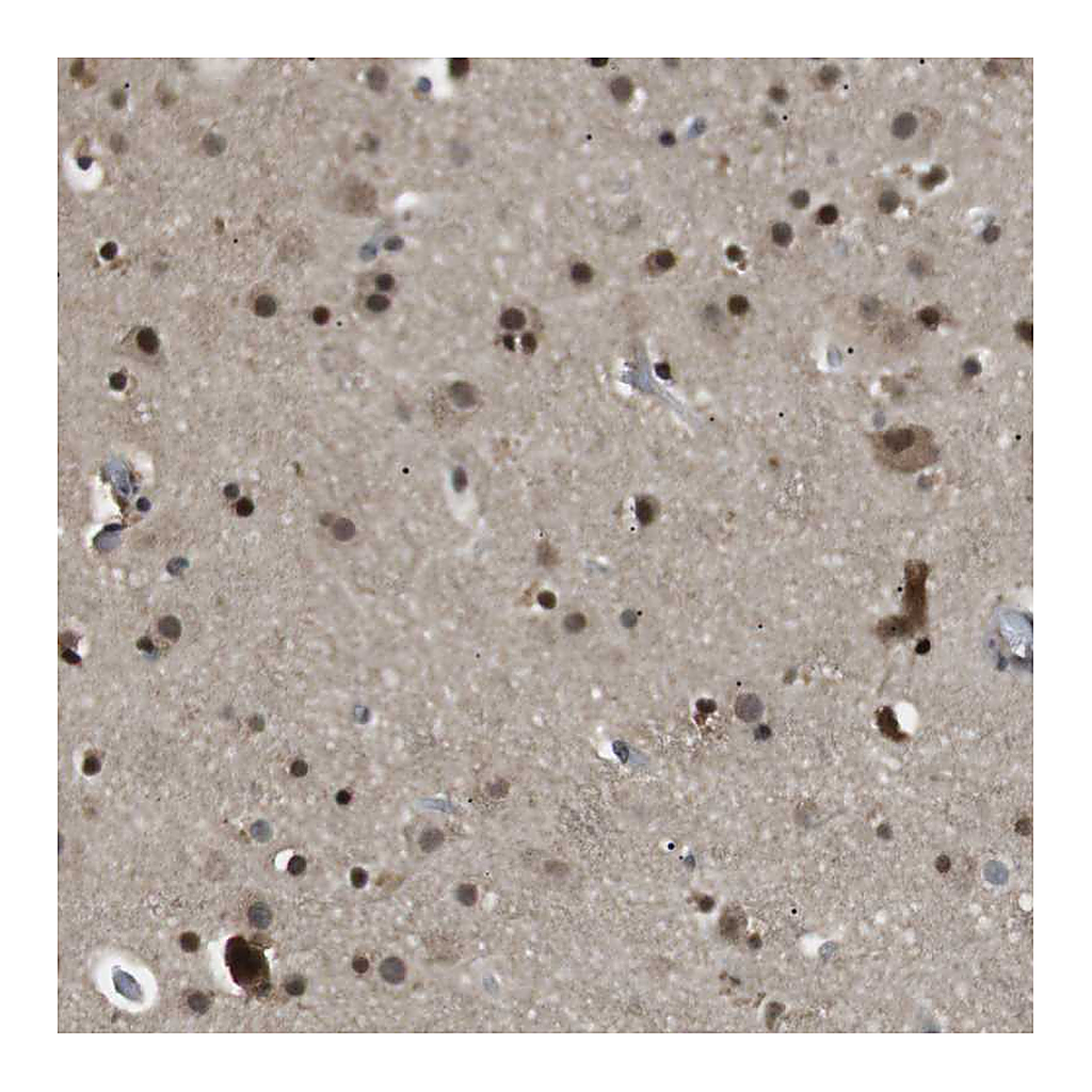 Atlas Antibodies Anti-ORAI3 Antibody