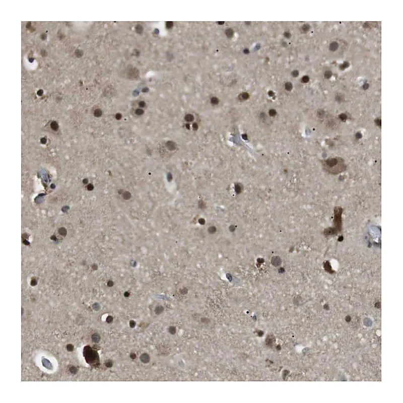 Atlas Antibodies Anti-ORAI3 Antibody