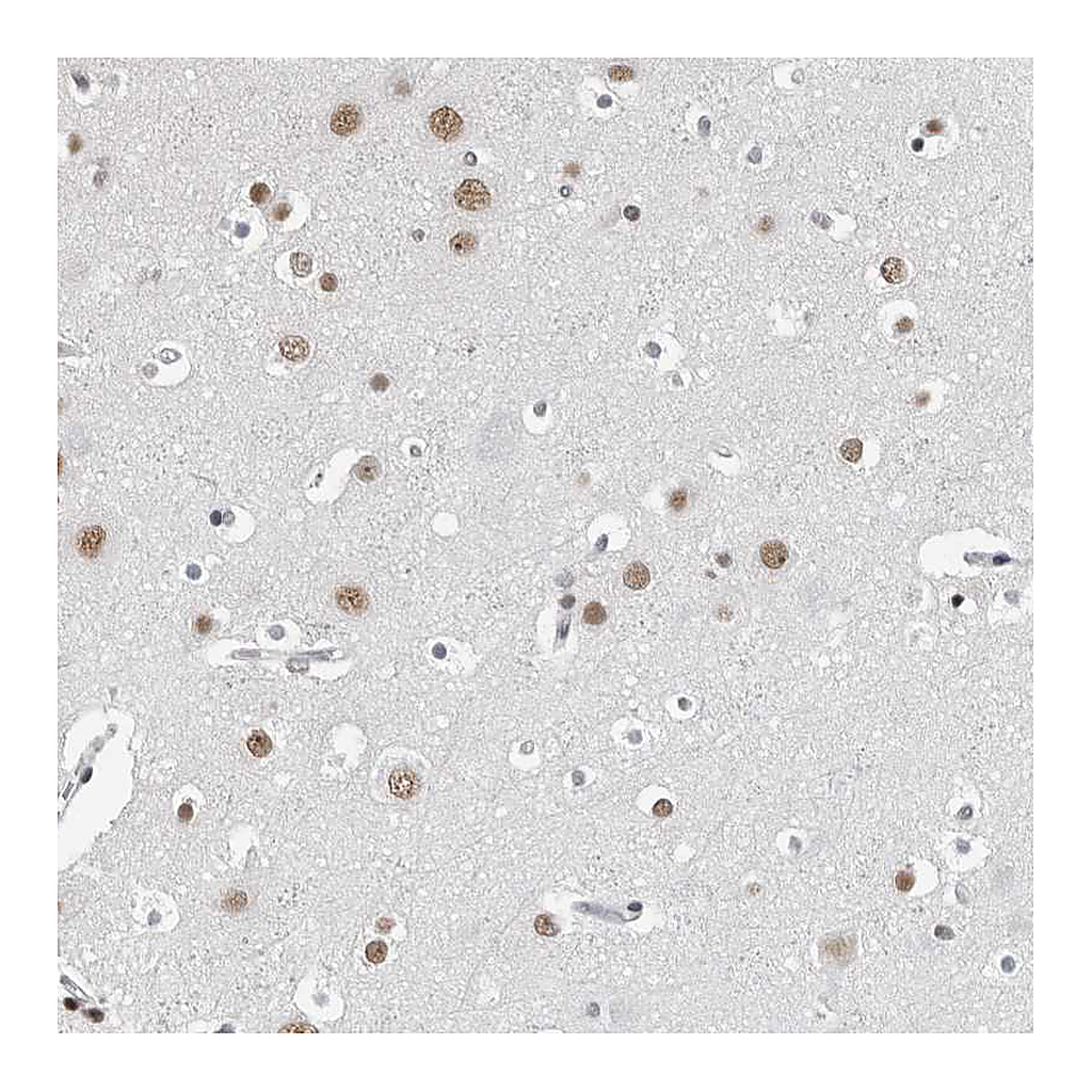 Atlas Antibodies Anti-ORC1 Antibody