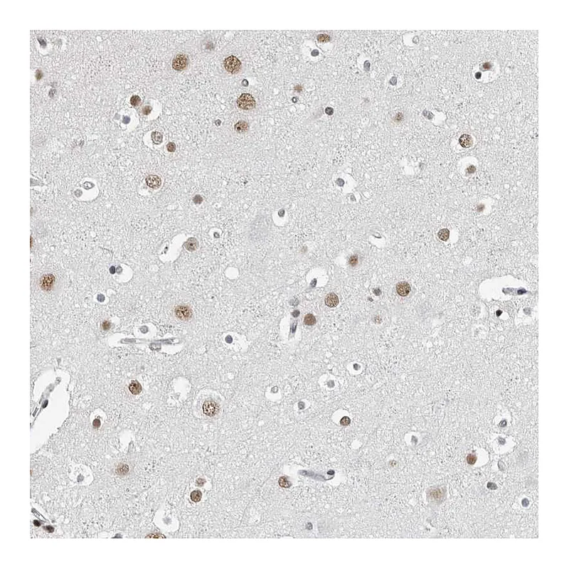 Atlas Antibodies Anti-ORC1 Antibody