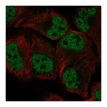 Atlas Antibodies Anti-ORC1 Antibody