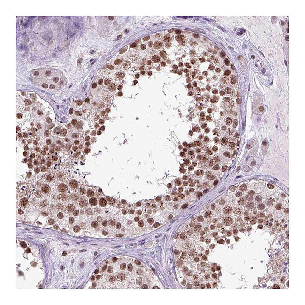 Atlas Antibodies Anti-ORC5 Antibody